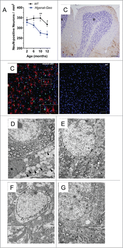 Figure 2. Pathological changes in the brains of Hgsnat-Geo mice. (A) Progressive loss of neurons in somatosensory cortex. NeuN-positive neurons were counted in 2 adjacent fields on 3 sagittal sections (1.44, 1.68 and 1.92 mm from bregma) of S1 somatosensory cortex; 2 male and 2 female mice were studied for each age and each genotype. Two-way repeated measurements ANOVA was used to test differences between the mouse groups: significant differences between the mean values in Bonferroni post-test (*P < 0.05, **P < 0.001, ***P < 0.0001) are shown. (B) Purkinje cells are largely absent in the lobule III of the anterior cerebellar lobe of Hgsnat-Geo mouse at the age of 12 months. H&E staining. Bar represents 50 µm. (C) Increased numbers of GFAP-positive astrocytes (red) and CD68-positive microglia (green) are detected in the somatosensory cortex of 4 months-old Hgsnat-Geo mice. (D) Storage pattern in microglia detected at 5 months. Massive accumulation of vacuoles with single limiting membranes and a sparse fine content in the cytoplasm is compatible with lysosomal GAG storage. Lysosomes containing storage materials are marked by arrowheads. The microglial cell (nucleus is marked by an asterisk) is in a close proximity to a cortical brain neuron. Bar represents 2 µm. (E) Lysosomal system in a cortical neuron at 12 months is expanded and massively overloaded by electron dense material (marked by arrows). Bar represents 2 µm. (F) Mitochondrial population in neurons of WT mice at the age of 12 months is relatively uniform and is composed of normally shaped mitochondria with largely regular cristae (details are shown in the insert). Bar represent 1 µm. (E) At the age of 12 months mitochondria in neurons of Hgsnat-Geo mice are displaying swelling and disorganization of their inner membranes (marked by arrowheads). Edematous mitochondria with largely dissolved cristae are marked by asterisks. Insert shows a detailed view of highly edematous mitochondria with remnants of double membranes (marked by double arrowheads). Bar represents 1 µm.