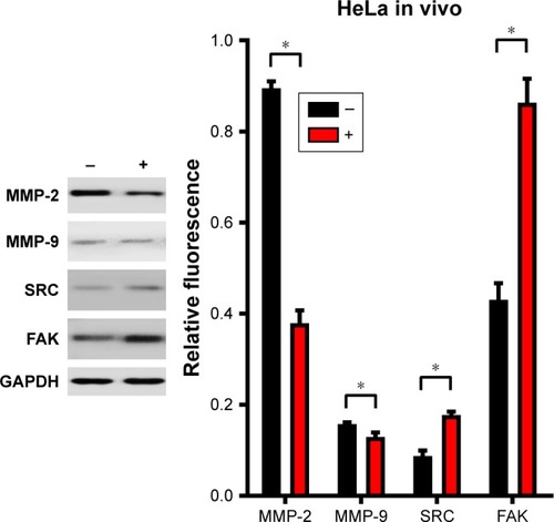 Figure 5 Subcutaneous tumors were isolated 2 weeks after subcutaneous injection of HeLa cells. The expression was normalized to that of GAPDH (n=4). Statistical analysis showed significant differences after stimulation (*P<0.05). The levels of MMP-2 and MMP-9 decreased, and the expression levels of SRC and FAK were upregulated. The migration of HeLa cells was suppressed by the CuS@SiO2 NPs (80 μg/mL), but it may not be directly associated with SRC and FAK signaling pathway.Abbreviations: FAK, focal adhesion kinase; MMP, matrix metalloproteinase; NP, nanoparticle.