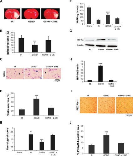 Figure 4 Effect of inhibition of HIF-1α by 2-ME on GSNO-mediated protective effects at 7 days after IR.