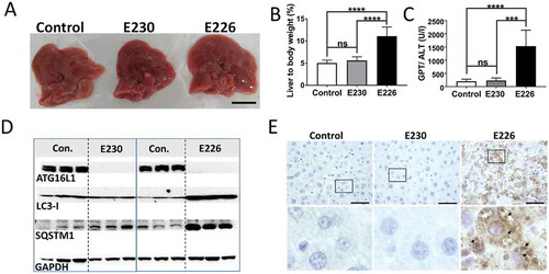 Figure 5. Analysis of autophagy substrates in liver. Panel (A) Representative livers at ~2 months (scale bar: 1 cm). (B) Liver weight expressed as a percentage of body weight at 2–3 months of age. E230 (atg16l1E230) n = 9, control n = 8; E226 (atg16l1E226) n = 9, control n = 7. (C) GPT/ALT in serum from mice aged between 2–3 months. E230 (atg16l1E230) n = 7, control n = 5; E226 (atg16l1E226) n = 5, v control n = 5. (D) Western blot of liver lysates from 3 representative mice. Membranes strips taken from the appropriate molecular weight range were analyzed separately using the indicted antibodies. (E) Representative histochemical sections of livers immunostained for SQSTM1. Enlarged regions of interest are shown in the lower panel. Arrows: SQSTM1 inclusions. In all figures data from littermate controls for E230 and E226 were pooled. Statistical analysis was done by unpaired t test. Error bars represents ±SEM. ****-P < 0.0001, ***-P < 0.001; ns, non-significant. Image magnification 40X, scale bars: 50 µm.