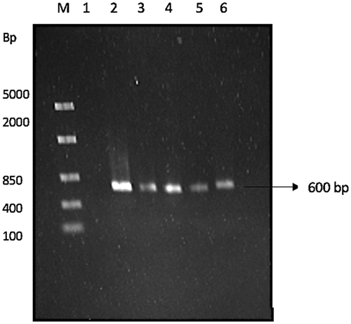Figure 1 Agarose (1%) gel showing 18s rRNA amplicon. lane M: marker, FastRuler middle range molecular weight ladder (Thermo Sientific, USA), lane 1: negative control, lane 2: CB1, lane 3: CB2, lane 4: PB7, lane 5: PS3, and lane 6: MS5, 600 bp between ITS5 and ITS4 region.