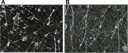 Figure 4 Follicular biopsy in volunteer 16.