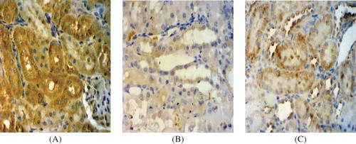 Figure 6. VEGF staining in tissue samples. (×400). (A) Control group at day 7. VEGF staining was most prominent in tubular epithelial cells in the control group. (B) Model group at day 7. The VEGF staining was significantly reduced. (C) PGE1 group at day 7. The VEGF staining was slightly decreased.
