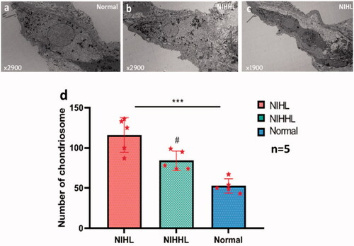 Figure 3. TEM images of IHCs in genuine pigs one month after noise exposure. Impulse noise resulted in increase and redistribution of chondriosomes in IHC. One month after impulse noise exposure, chondriosomes of animals in NIHHL and NIHL were significantly increased (d) and obviously bipolar distributed. NIHL: noise induced hearing loss group; NIHHL: noise induced hidden hearing loss group; Normal: normal group. #: p < .05, NIHHL versus Normal; ***: p < .001 NIHL versus NIHHL versus Normal n = 5.