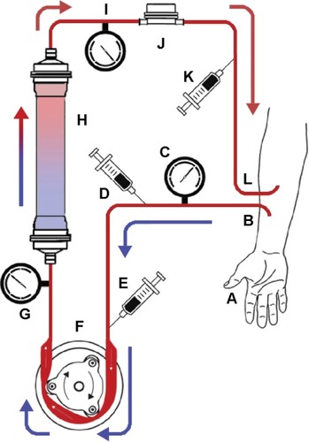 Figure 1 Schematic diagram of proposed setup for prospective auxiliary treatment of sepses.