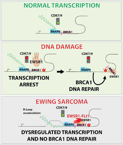 Figure 1. Altered control of transcription in Ewing sarcoma. Transcription elongation is triggered by cyclin dependent kinase 9 (CDK9) dependent phosphorylation of RNA Polymerase II (RNAPII) C-terminal domain. EWS RNA binding protein 1 (EWSR1) inhibits this phosphorylation event thereby controlling transcription rates. BRCA1, DNA repair associated protein (BRCA1) is associated with hyper-phosphorylated RNAPII under basal conditions but is released upon infliction of DNA damage to sites of break repair. However in Ewing sarcoma, EWS-FLI1 allows aberrant transcription by lifting EWSR1 dependent inhibition of CDK9 activity resulting in R-loop accumulation. This, in turn, prevents BRCA1 release from transcription complexes thus impairing homologous recombination repair of exogenously induced double strand breaks.