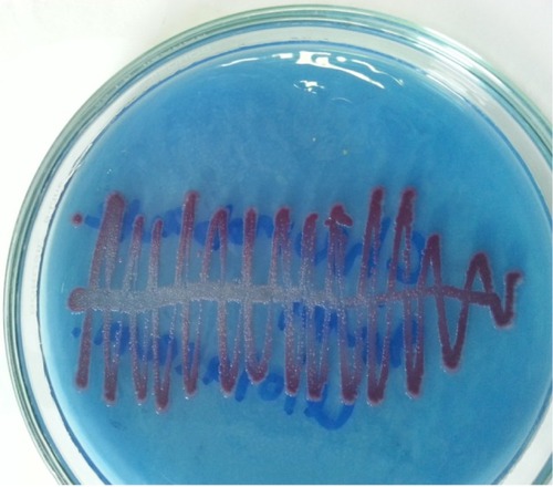 Figure 1 Growth of Chromobacterium violaceum in CLED agar.