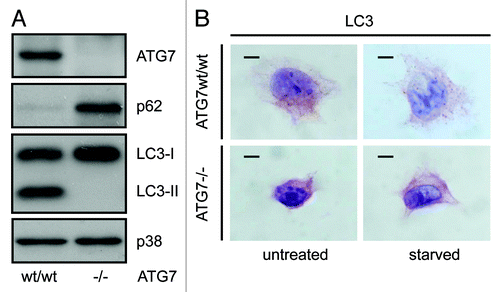 Figure 1. LC3 immunohistochemical staining shows a punctate pattern in wild-type MEFs and a homogenous staining pattern in atg7−/− MEFs. (A) Western blot of ATG7, SQSTM1/p62, LC3-I and LC3-II and MAPK14/p38 in wild-type and atg7−/− MEFs. (B) Representative images of immunohistochemical detection of LC3 in wild-type and atg7−/− MEFs that were cultured in replete medium (untreated) or starved in EBSS for 2 h. Antigen retrieval was undertaken in Tris-EDTA, pH 9. Images were taken at 100x magnification and the scale bars in each panel represent 20 µm.