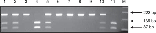 Figure 1b Agarose gel electrophorsis 2.5% stained with ethidium bromide showing the ICAM-1 DNA product after digestion with BstUI. Lanes 1, 2, 5, 10: EK allelic polymorphism. Lanes 3, 6–9: KK allelic polymorphism. Lanes 4, 11: EE allelic polymorphism.