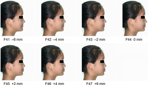 Figure 4 Models of chromophotograph of the girl with different lip positions (F41–F47).