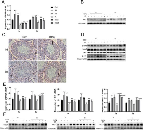 Figure 5. SFN upregulated Nrf2 expression and restricted NFκB activation in the testis after ionizing radiation. (A) Nrf2 expression at mRNA level was detected by real-time PCR. (B) Nrf2 expression at protein level was detected by Western blot. (C) The activation of Nrf2 was examined by immunohistochemical staining (bar = 50μm). →Indicates p-Nrf2 positive cells. (D) Western blot for Nrf2 phosphorylation at Ser40 (p-Nrf2), Keap1, p65, p-p65. (E), (F) Nrf2 function was measured by determining the expression of Nrf2 downstream genes, SOD1, heme oxygenase 1 (HO-1), and NAD(P)H: quinone oxidoreductase (NQO1) at mRNA and protein levels. n = 3 in each group. * p < 0.05, ** p < 0.01, *** p < 0.001vs Ctrl; # p < 0.05, ## p < 0.01, ### p < 0.001vs IR.