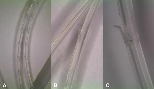 Figure 1 Microscopic Images of PLCL threads: Stereomicroscopy was performed at magnifications of 6.7x (A), 20x (B) and 40x (C); PLCL threads (12 cm and 23.2) cm were both seen to have notches that create periodic, bi-directional barbs along their lengths.Citation14