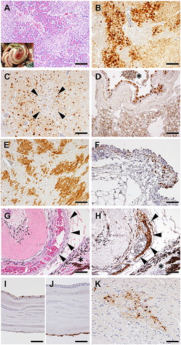 Figure 3. Histological analysis of tissues from American kestrels inoculated with the clade 2.3.2.1 H5 HPAIV. Representative gross (inset) and histological lesions of pancreas sections (A). Histological structure around Schlemm’s canal with HE staining (G). Representative immunohistochemical staining of pancreas (B), brain (C), lung (D), heart (E), conjunctiva (F), Schlemm’s canal (H), corneal epithelium and endothelium (I and J), and optic nerve (K). Arrowheads in Figure 3(C) indicate multifocal cerebral necrosis. The asterisk in Figure 3(D) indicates bronchial lumen. In Figure 3(G,H), arrowheads and asterisk indicate Schlemm’s canal and ciliary body, respectively. Scale bars: 100 µm (A–E, G, H); 50 µm (F, I–K).