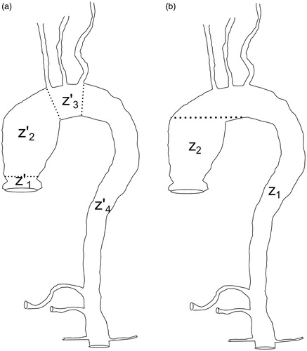Figure 1. (a) Clinically established regions of the thoracic aorta. The figure includes the supra-aortic trunks (brachicephalic trunk, left subclavian artery and left common carotid artery) and the visceral trunks (renal arteries, celiac trunk and superior mesenteric artery). (b) Regions of the thoracic aorta segmented using the automatic method.