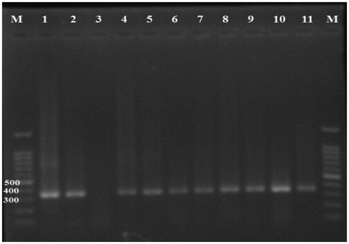 Figure 1. Nested-PCR products of the GRA6 gene. T. gondii positive samples give a 344-bp band. M: 100 bp DNA marker; lane 1 positive control, lane 3 negative control, lanes 2, 4–11 positive samples.