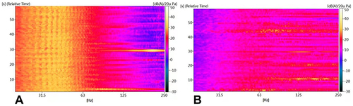 Figure 5 Spectrogram of heart sound signals of all ten volunteers measured using stethoscope (A) the cylindrical tube stethoscope. (B) the 3 M stethoscope.