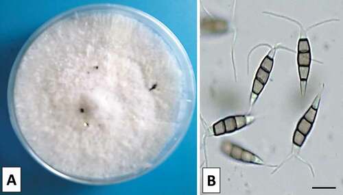 Fig. 2 Morphological characteristics of Pestalotiopsos biciliata; colony with conidiomata on PDA after 10 d growth at 25°C (a) and conidia with concolorous median cells (b). Scale bars: 10 μm.