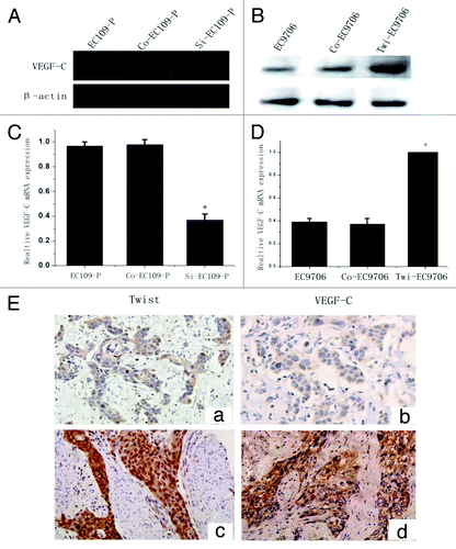 Figure 5. Twist regulates VEGF-C expression in ESCC cells and tissues. (A and B) WB analysis of VEGF-C protein expression in twist down and upregulated cells. β-actin was used as a loading control. (C and D) Relative VEGF-C mRNA expression in twist down and upregulated cells by real time PCR analysis. (E) Co-expression of twist and VEGF-C in ESCC tissues. (a) Negative twist expression in the nucleus correlated with (b) lower VEGF-C expressionin the same patients. (c) Strong twist expression in the nucleus correlated with (d) high VEGF-C expression in the same samples (Original magnification, 200x).