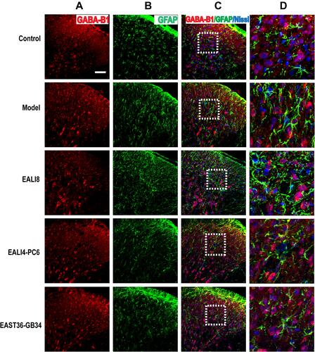 Figure 7 No co-expression of GABA-B1, GFAP, and Nissl was found. Representative confocal images of C4-C5 spinal cord sections showed no coexpression of GABA-B1 (red) and GFAP (green) and Nissl (blue) in the superficial laminae of C4-C5 DHs at 24h after modeling in rats. Results showed no expression of GABA-B1 in astrocytes. (A) GABA-B1, (B) GFAP, (C) merge, (D) magnification of the dashed squares from their left merged images. The bar on the top-left image represents 50µm.