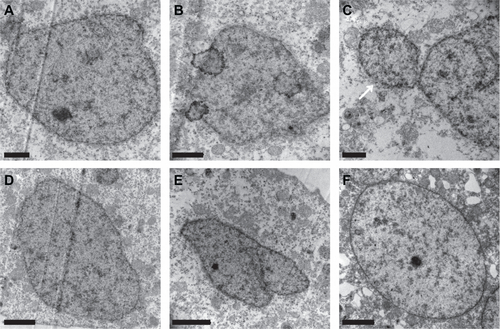 Figure S1 Representative transmission electron microscopy graphs of the nucleus of the blastoderm cells of the embryos loaded with FITC-BSA-MWCNTs at one-cell stage (A–E) and untreated control (F) at 6 hpf. Embryos loaded with FITC-BSA-MWCNTs had irregular shape of nucleus and some micro-nucleus structure also appeared in treated embryos (see white arrow in C), while cells of the untreated embryos had regular round or a horse-shoe shaped nucleus at 6 hpf. Scale bar is 1 μm in A, B and C, and 2 μm in D, E and F.Abbreviations: FITC-BSA-MWCNT, fluorescein isothiocyanate-labeled bovine serum albumin-functionalized multiwalled carbon nanotube; hpf, hours postfertilization.