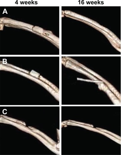 Figure 5 Three-dimensional tomographic images of the segmental radius at 4 and 16 weeks.Notes: (A) BMP2-loaded hollow HA microspheres; (B) hollow HA microspheres without BMP2; (C) soluble BMP2 without a carrier.Abbreviations: HA, hydroxyapatite; BMP2, bone morphogenetic protein 2.