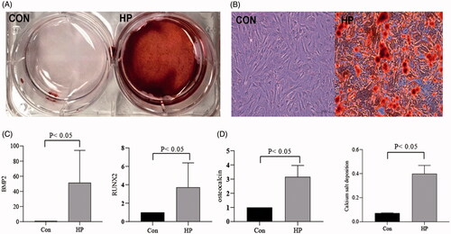 Figure 1. High phosphate induced osteoblast differentiation and calcification in VSMCs. (A) Alizarin red staining in general; (B) Alizarin red staining under microscope; (C) Compared the expression of Bone Morphogenetic Protein 2 (BMP2), Run-related transcription factor 2(RUNX2) and osteocalcin in RT-qPCR; (D) Compared the intracellular calcium concentration of the two groups.