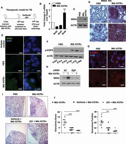 Figure 1. Epigenetic reader, BRD4, supports TB pathogenesis in vivo. (A) Schematic for the in vivo mouse TB model and therapeutic treatment regimen. (B) Lung homogenates from mice aerosol infected with Mtb H37Rv for 44 d were assessed for the expression of BRD family genes by qRT-PCR. (C-E) Lungs of mice infected with Mtb H37Rv for 44 d were assessed for the protein level expression of BRD4 by (C) immunoblotting in lung homogenates; (D) immunohistochemistry in infected lung sections and (E) by immunofluorescence imaging on infected lung cryosections. (F and G) The activation of EGFR was assessed (F) in the lung homogenates of 44 d-Mtb H37Rv-infected mice by immunoblotting, and (G) in the infected lung cryosections by immunofluorescence microscopy. (H) Mouse peritoneal macrophages were transfected with NT or Egfr siRNA and infected with Mtb H37Rv for 12 h. Whole cell lysates were assessed for BRD4 expression by immunoblotting. (I and J) H and E staining of lung sections of uninfected/infected/and inhibitor-treated mice (representative image, I; 40X; scale bar: 200 μm; G = granulomatous lesion; AS = alveolar space) and the respective quantification of granuloma score (J, left panel) and granuloma fraction (J, right panel). All qRT-PCR data represents mean±S.E.M. and immunoblotting data is representative of three independent experiments. At least 3 mice were utilized for each analysis derived from lung tissues obtained following therapeutic TB model. Granuloma score and fraction were evaluated in total 8 mice from two independent experiments. Med, medium; *** p < 0.001; ****, p < 0.0001 (Student’s t-test in B; One-way ANOVA in J; GraphPad Prism 8.0); scale bar for IF: 10 μm; Immunohistochemistry (IHC) magnification, 20X (upper panel; scale bar: 300 μm) and 40X (lower panel). ACTB was utilized as loading control.