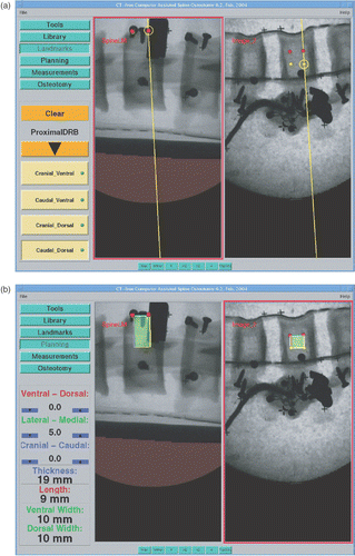 Figure 2. Fluoroscopy image-based intra-operative planning of the graft bed. (a) Four deep-seated landmarks (displayed as two red spheres and two yellow spheres) which locate the four corners of the graft bed in the cranial-ventral, caudal-ventral, cranial-dorsal, and caudal-dorsal directions, respectively, are acquired with a bi-planar landmark reconstruction technique and used to guide the planning. (b) The surgeon can interactively adjust the position and orientation of the virtual graft bed model by comparing the projection of the graft bed model with the underlying anatomical images. [Color version available online.]