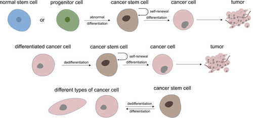 Figure 1 Two main theory of where cancer stem cells may be derived from and the heterogeneity and plasticity characteristic of UM-CSC.
