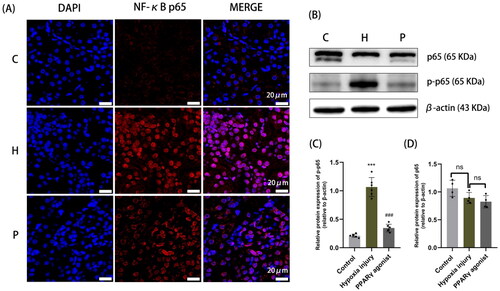 Figure 3. Localization and protein expression of NF-κB in renal tissue. (A) Immunofluorescence staining with paraffin sections, with NF-κB p65 shown in red and DAPI nuclear staining shown in blue (magnification 630×); (B-D) Protein expression of NF-κB p65 in rat kidney detected by Western blot analysis. Data are expressed as mean ± SD, n = 6/group. ***p < .001 compared with the control group; ###p < .001 compared with the hypoxia injury group. C: Control group; H: Hypoxia injury group; P: PPARγ agonist group.