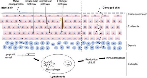 Figure 1 Skin penetration of metal NPs.Notes: Three main possible skin-penetration pathways are illustrated: the intracellular pathway, intercellular pathway, and follicular pathway. Metal NPs may penetrate the stratum corneum in healthy skin. In damaged skin, more NPs may penetrate the epidermis and dermis. They may move to the lymph modes and be engulfed by macrophages. During penetration, metal NPs release metal ions, which induce metal ion-specific CD4+ T-cell and IL17-mediated immunoreactions.Abbreviation: NPs, nanoparticles.