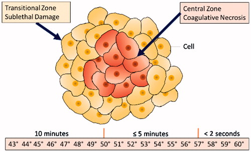 Figure 1. Temperatures and times for thermal damage within tissue.