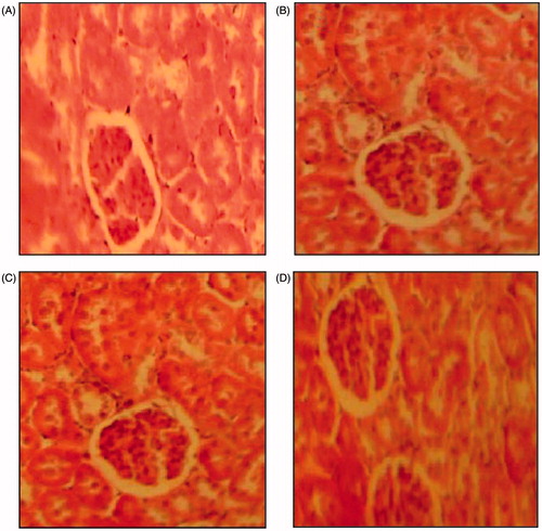 Figure 5. Histopathological studies of kidney in control (A), high-cholesterol fed (B), green tea-supplemented rats (C), and kombucha-supplemented rats (D) (hematoxylin–eosin, H&E staining, 100×).