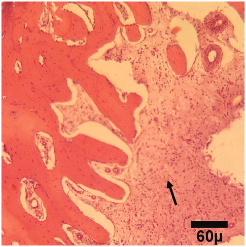 Figure 2. Microscopic section from the healing site of HA-treated group on day 15 of healing shows a fibrous tissue (arrow) (H&E, ×100).