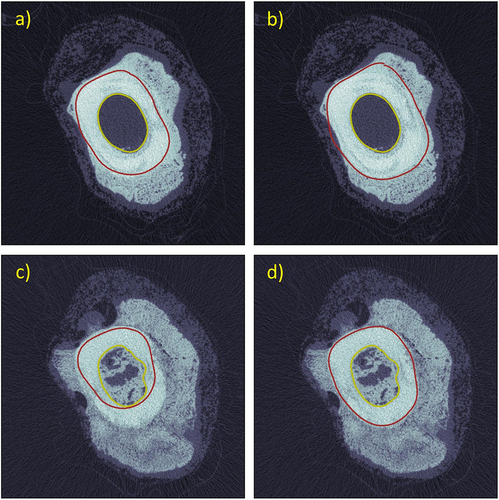 Figure 8. Detection of pericortical boundaries in the same slice images of figure 7. a/b) pericortical boundary was properly detected with τperi = 7,600, but was improperly dilated with τperi = 7,000 (correct threshold in d). c/d) pericortical boundary was severely eroded with τperi = 7,600 (correct threshold in a), but correctly follows pericortical wall with τperi = 7,000.