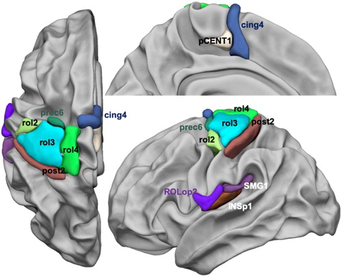 Figure 1. Display of the 12 supratentorial hROIs contralaterally activated and having significantly larger contralateral minus ipsilateral asymmetry in both right and left finger tapping tasks. (Abbreviations: Rolandic sulcus: rol, cingulate sulcus: cing, precentral sulcus: prec, paracentral gyrus: pCENT1, Rolandic operculum: ROLop, supramarginal gyrus: SMG, posterior insula: INSp1).