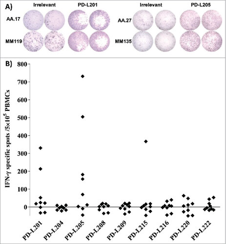 Figure 1. Screening for T-cell responses towards minimal peptides derived from PD-L2. (A) Examples of ELISPOT results for PBMCs isolated from patients with malignant melanoma (AA and MM), in response to PD-L201 (PD-L24-12; LLLMLSLEL) and PD-L205 (PD-L216-25; QIAALFTVTV). (B) In-vitro IFN-γ ELISPOT results. PBMCs from 9 patients with malignant melanoma were stimulated once in vitro with each peptide. Then, the PBMCs were exposed to the peptides, and IFN-γ secretion was measured with ELISPOT. The response was calculated as the number of peptide-specific spots, minus the number of spots that reacted to an irrelevant peptide (HIV/HLA-A2; pol476-484; ILKEPVHGV), per5 × 105 PBMCs.