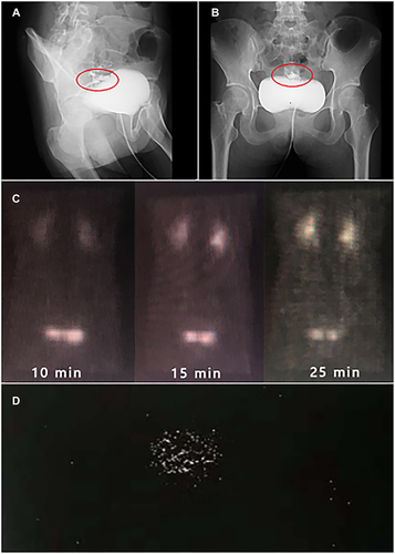 Figure 1 Cystography, renal dynamic imaging and stool imaging.