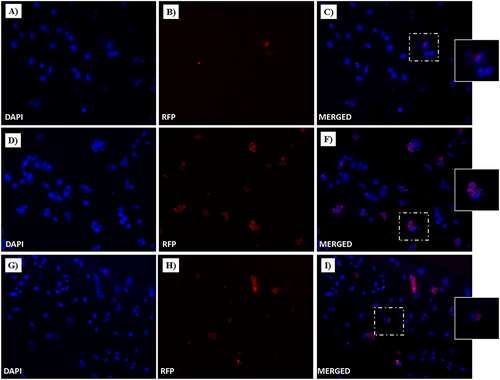 Figure 17 Fluorescent microphotographs showing the cellular location of Dox into human MDA-MB-231 TNBC cells after cellular up-take inhibition low temperature (4 °C) and then to free-Dox (A–C), NF-Dox (D–F) and P1+P2+P3+Dox (G–I) application. MDA-MB-231 were incubated with free-Dox (7.5 μM), NF-Dox and P1+P2+P3+Dox (50 µM, ie, 7.5 µM of Dox) for 1 h. Nuclei are shown in blue, stained with DAPI. The intrinsically fluorescence of Dox (RFP channel) is shown in red. Merged images derived from the overlapping of the two fluorescent emissions. The images shown are representative of 3 independent experiments.