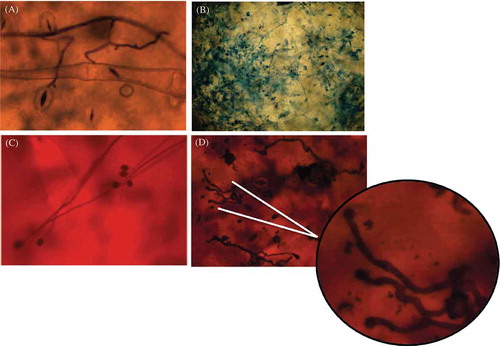 Fig. 2 (Colour online) Development of Phytophthora infestans at a microscopic level on inoculated P. peruviana leaves and potato leaflets. (A) Sporangial germination on infected P. peruviana leaves. Abundant mycelial growth was observed at 48 hai. (B) Formation of new zoosporangia was not seen on P. peruviana, in contrast to what was observed on potato leaflets. (C, D) Appressoria formation observed on P. peruviana leaves. Strain 4084, originally isolated from P. peruviana, was used for (A, B) and strain 2400 originally isolated from potato was used for (C, D).