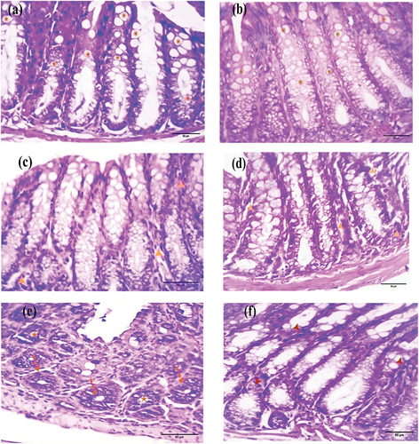 Figure 1. Photomicrographs of colorectal sections post-4 weeks through the mucosal layer showing the epithelium of (a) control and (b) EDTA groups rich with goblet cells (asterisks), (c) DMSO and (d) Nic groups with the normal structure of the mucosa within a few inflammatory cells (arrowheads), (e) DMH group with aberrant crypt foci (ACF) (dashed arrows) and goblet cell reduction (stars), and (f) Nic-DMH group with scattered inflammatory cells (arrowheads) (H&E stain, scale bar: 50 µm).