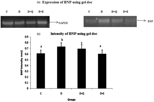 Figure 7. The relative amount of BNP mRNA was estimated by semi-quantitative RT-PCR. The PCR products were quantified by densitometry and standardized to their respective GAPDH controls. The mean intensity was measured and expressed as INT/mm2. Results are expressed as average of quadruplicate experiments ± SD statistically significant p ≤ 0.05.