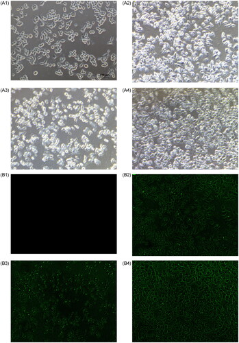 Figure 4. Representative surface morphology of KB cells. Phase-contrast image of control KB cells without treatment (A1), KB1 = cells treated with docetaxel-cisplatin-fluorouracil (A2), KB2 = cells treated with the docetaxel-cisplatin-fluorouracil-Au complex (A3), and KB3 = cells treated with plain Au nanoparticles (A4). Fluorescence image of control KB cells without treatment (B1), KB1 = cells treated with docetaxel-cisplatin-fluorouracil (B2), KB2 = cells treated with the docetaxel-cisplatin-fluorouracil-Au complex (B3), and KB3 = cells treated with plain Au nanoparticles (B4). Objective: 40×.