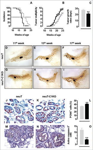 Figure 1. C1q deficiency is responsible for accelerated tumor growth in neuT mice. Tumor incidence (A) and multiplicity (B) of mammary carcinomas in neuT (n = 30, gray line) and neuT-C1KO (n = 18, black line) mice. Earlier incidence (***p < 0.0001, Log-rank Mantel-Cox test) and higher tumor multiplicity (starting from the 17th week of age, p values ranging from 0.04 to <0.0001, Student's t-test) were found in neuT-C1KO as compared with neuT mice. (C) Time required for a 2 mm mean diameter tumor to reach an 8 mm threshold. Tumors that arose in neuT-C1KO (black bar) mice grew significantly faster than those growing in neuT (gray bar) mice (**p = 0.001, two-tailed Student's t-test). (D–I) Representative whole mount images of the fourth (inguinal) mammary glands of 11- (D, G), 15- (E–H), 17- (F, I) week-old neuT (D–F) and neuT-C1KO (G–I) mice. The central oval black shadows are the intra-mammary lymph nodes. Magnification × 6.3. (J, K) Histological and immunohistochemical staining for the PCNA of mammary tumor lesions in neuT (J) and neuT-C1KO (K) mice. Magnification × 400. PCNA+ tumor cell quantification (L) in neuT (gray bar) and in neuT-C1KO (black bar) mice (**p = 0.001, two-tailed Student's t-test). (M, N) Histological and immunohistochemical staining for the active caspase-3 in mammary tumor lesions of neuT (M) and neuT-C1KO (N) mice. Black arrows indicate apoptotic tumor cells. Magnification × 400. Active caspase-3+ tumor cell quantification (O) in neuT (gray bar) and in neuT-C1KO (black bar) mice (**p = 0.002, two-tailed Student's t-test).