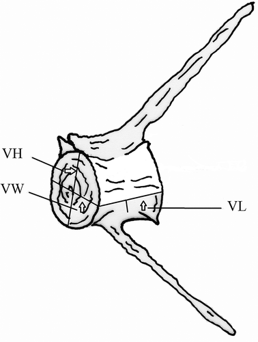 Figure 1. Hypothetical vertebra showing the three measurements of the vertebral centrum. VL, central length; VH, central height; VW, central width.