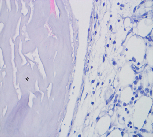 Figure S1 A representative histology image showing the interface of the control membrane and the surrounding subcutaneous tissue on day 4 after implantation.Notes: Scanty tissue attachment and minimal infiltration of inflammatory cells was noted on the surface of the membrane in all groups. Asterisk indicates the residual membrane.