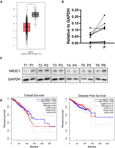 Figure 5 NR3C1 is downregulated in human breast cancer specimens. (A) The mRNA expression of NR3C1 was analyzed using TCGA-BRCA dataset through GEPIA and the results showed that the expression level of NR3C1 in breast tumors was lower than that in normal tissues. (B) The mRNA expression of NR3C1 in breast tumor species was lower than that in paired para-tumor tissues analyzed by Real-time PCR. n=12. (C) The protein expression of NR3C1 in 6 paired breast cancer (T) and para-tumor (P) tissues were analyzed by Western blot. (D) The correlation of NR3C1 mRNA expression with overall survival and disease-free survival of patients with breast cancer from TCGA-BRCA dataset analyzed through GEPIA. Data are shown as the means ± SEM. Student’s T-Test, *P < 0.05.