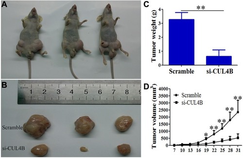 Figure 4 CUL4B promotes GC growth in vivo. CUL4B knockdown inhibited GC in nude mice (A, B). Tumor weight (C) and volume (D) were decreased in mice xenografted with si-CUL4B cells compared to control mice (*P<0.05, **P<0.01).