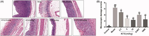 Figure 2. Histological assessment of the effects of KFX on the acute gastric mucosal injuries in WIRS-challenged rats. (A) The gastric tissue was fixed with 4% paraformaldehyde and sectioned to prepare for HE staining. The gastric tissue sections were routinely dehydrated, and then stained with haematoxylin and eosin followed by observation with a microscope. (B) The statistic results of gastric microscopic damage scores. The data were expressed as the means ± SD (n = 5). KFX: Kangfuxin liquid; SJWT: Sanjiuweitai Granules; OME: Omeprazole.