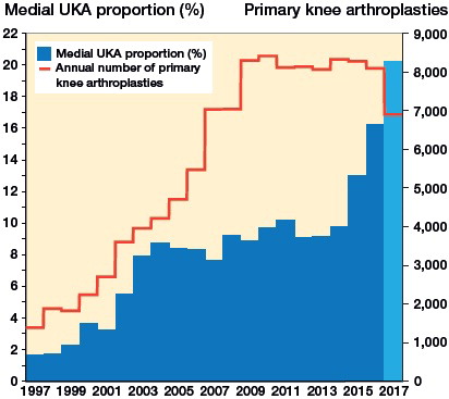 Figure 2. Annual use of medial UKAs. The national percentage of all primary knee arthroplasties accounted for by medial unicompartmental arthroplasties (UKAs) each year and the annual numbers of all primary arthroplasties. The numbers account for all registered knee arthroplasty procedures except revisions. Note that the dataset contains only procedures up to December 4, 2017, which is why the numbers for 2017 should be interpreted with caution.